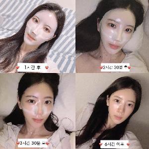 Mặt Nạ dưỡng trắng & cấp ẩm Derm-all Matrix 